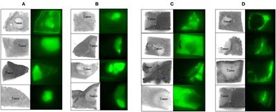 Near-Infrared Fluorescence Imaging and Photodynamic Therapy for Liver Tumors